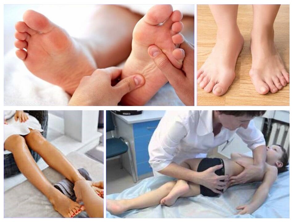 A deformación do valgus no tratamento dos nenos