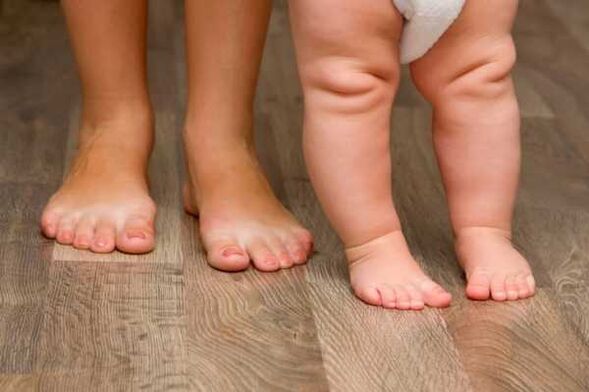 Deformación de valgus nos nenos