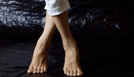 Deformación do valgus