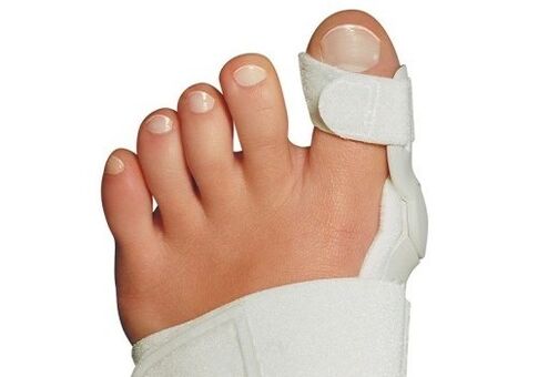 Deformación do valgus